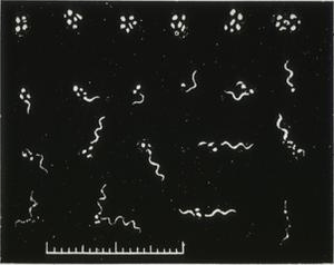 Borrelios_varianter